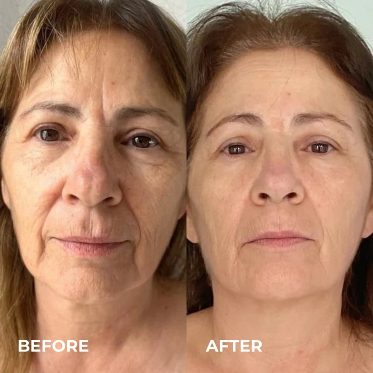 Before and after results 2