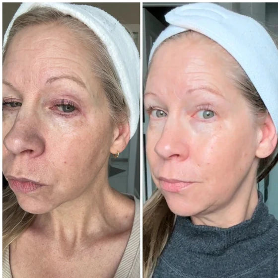 Before and after results 3