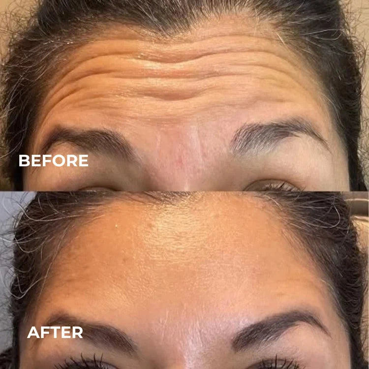 Before and after results 1
